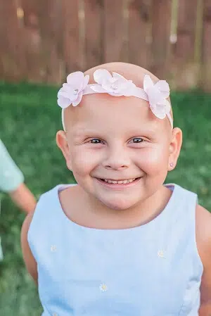 Click to read article: Alopecia'