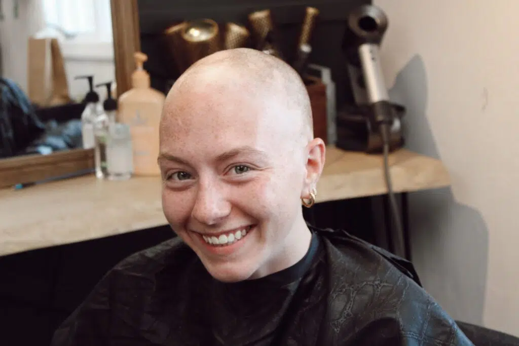 Click to read article: Alaina a Division I Athlete Spreads Awareness About Alopecia'