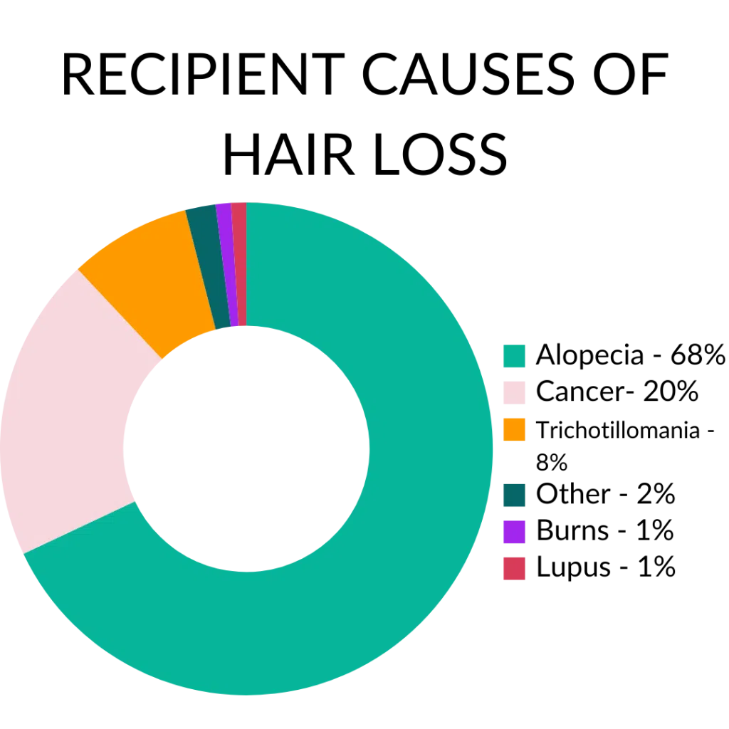 Causes of hair loss in our recipients we served
